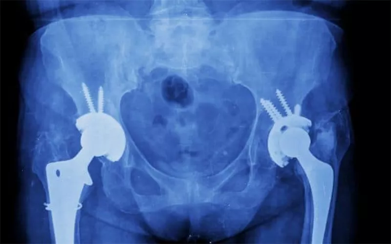 氧化锆接头球头